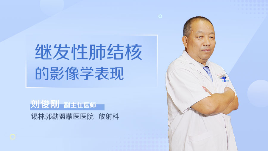 肺结核继发型_继发性肺结核严重吗_肺结核继发症