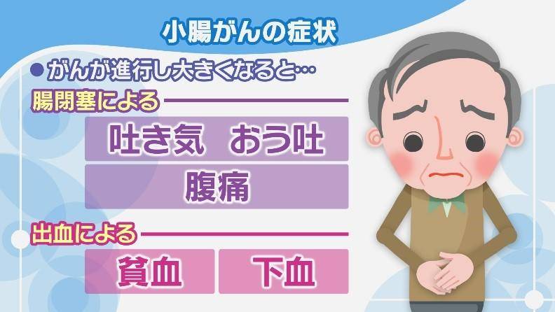 克罗恩病诊断书写_罗克罗恩病的特征性体征_克罗恩病诊断