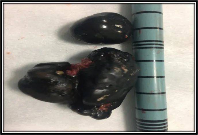 序列号开头字母代表什么_序列号查询苹果_xp sp3 en 序列号