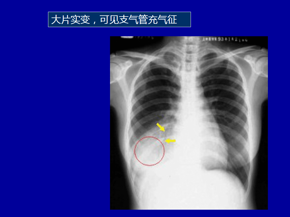 脸白与肺_脸白与肺_脸白与肺