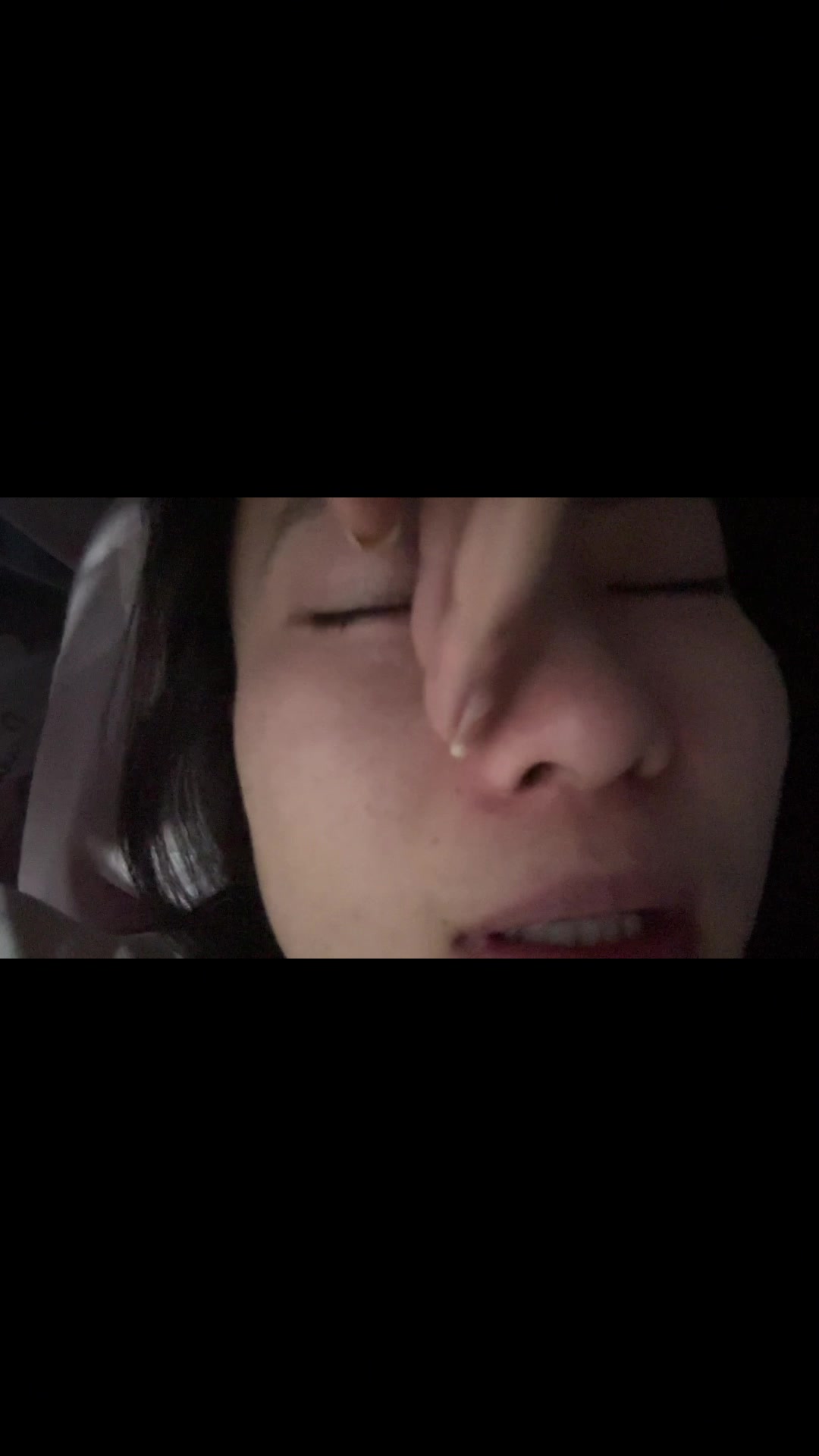 春天脸脱皮是什么原因引起的_春天全脸脱皮_春天脸脱皮是什么原因