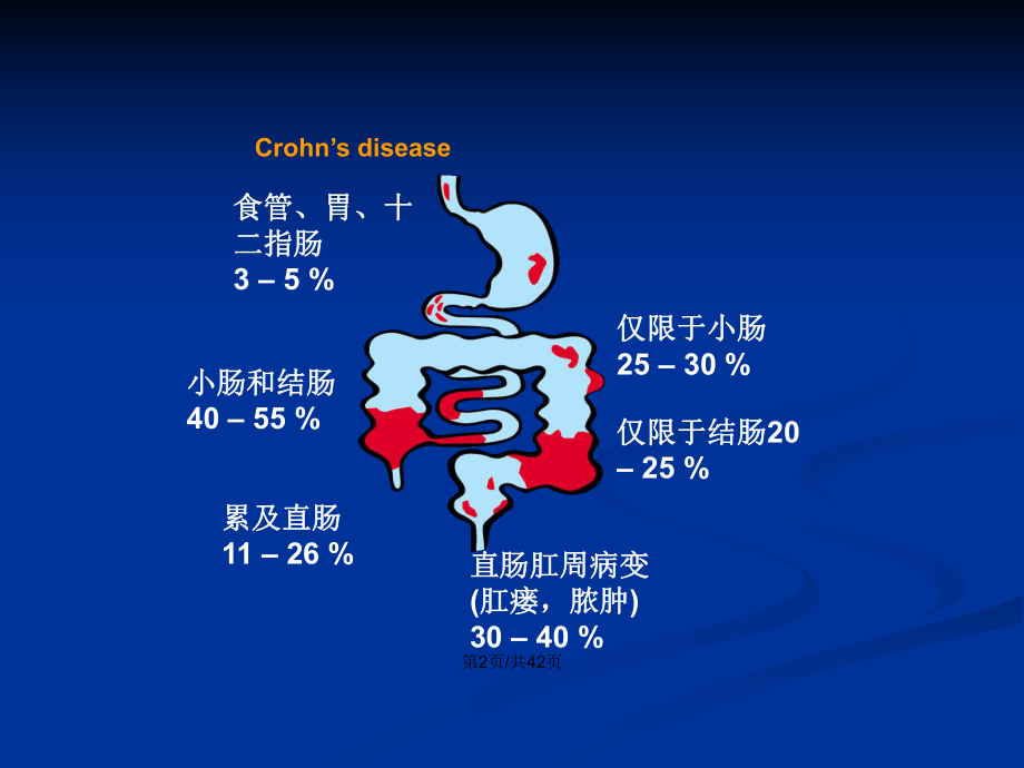 罗克恩病能治好吗_冶克罗恩的中药_克罗恩病/中医药治疗