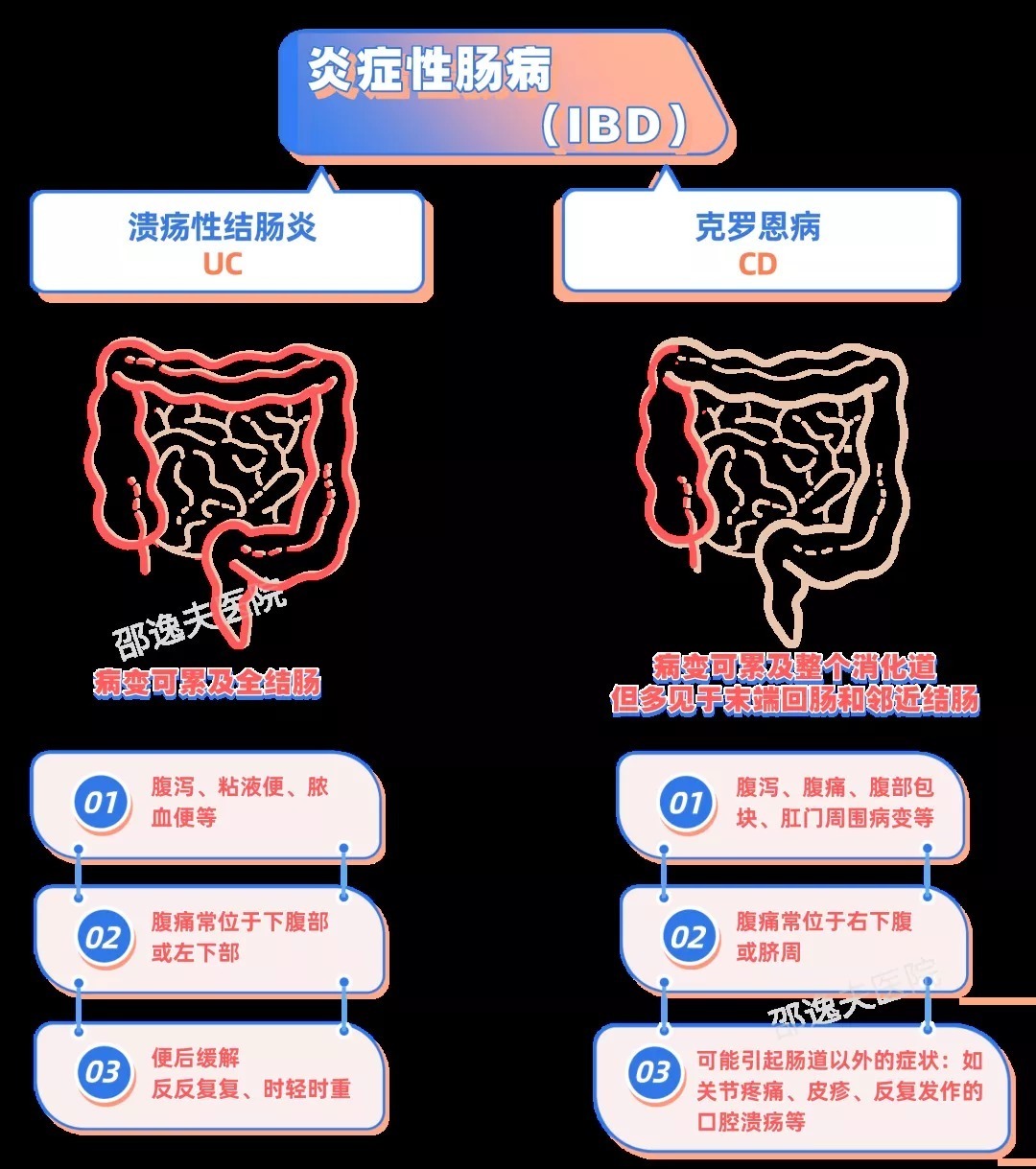 克罗恩病关节炎_克罗恩导致的关节炎的症状_克罗恩病关节炎治疗