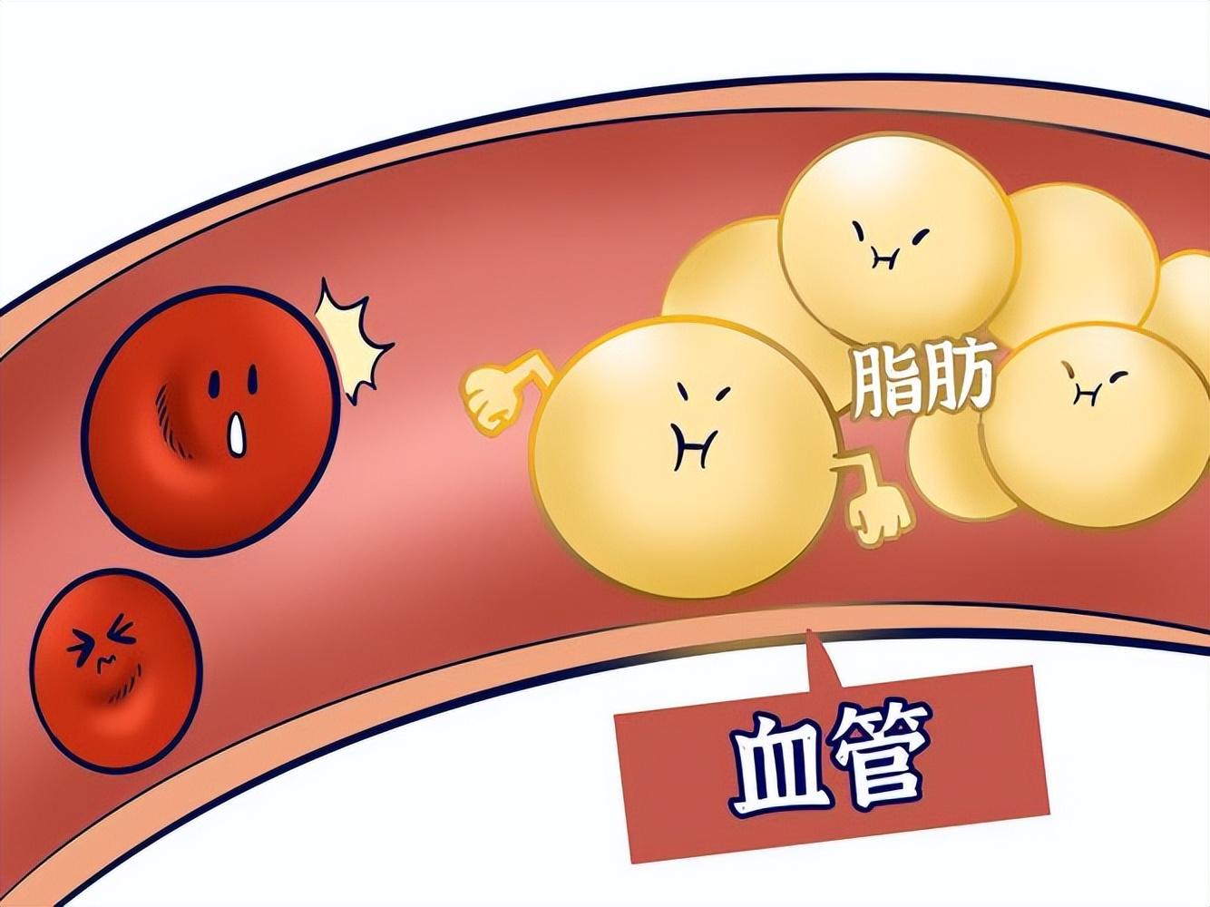 心梗介入治疗并发症_介入治疗心梗过程_治疗心梗介入性手术复杂