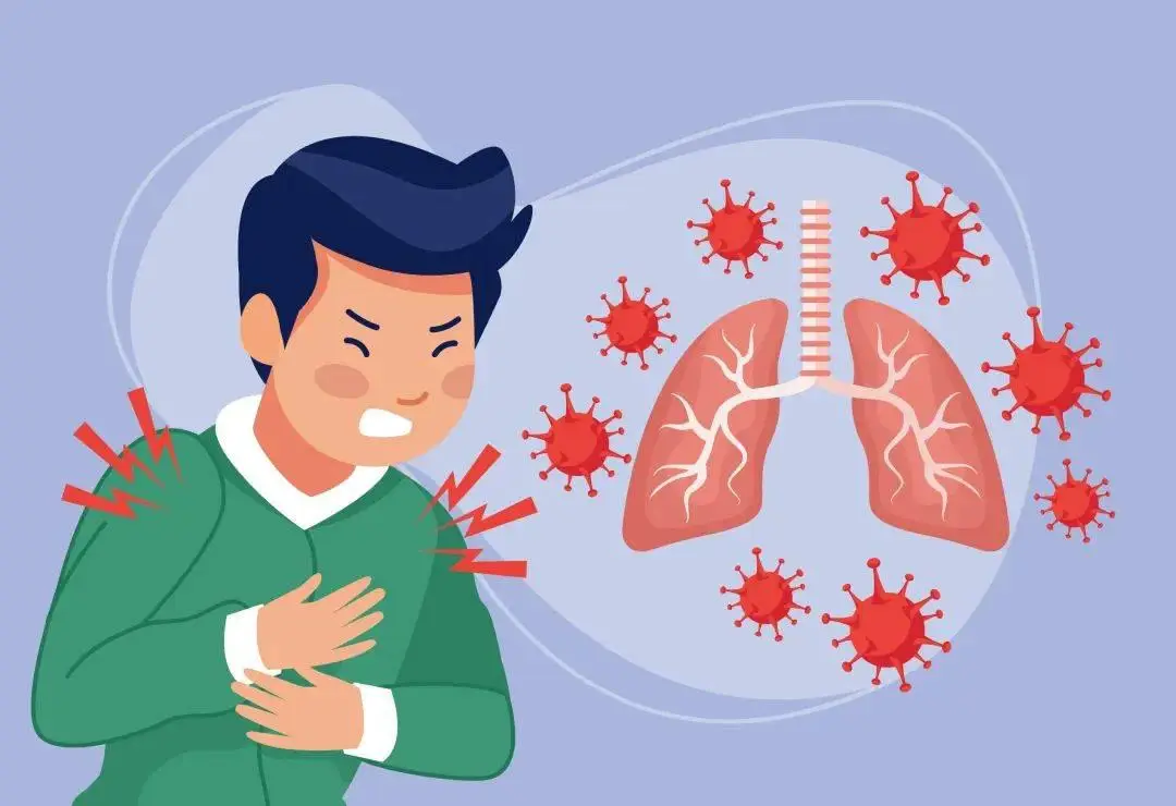 呼吸合胞病毒性肺炎_呼吸道合胞病毒肺炎_呼吸道合胞病毒(rsv)肺炎