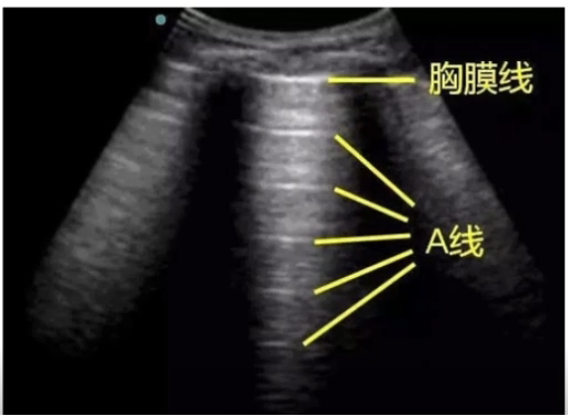 呼吸衰竭定义及分类_呼吸衰竭定义和分类_呼吸定义分类衰竭的标准