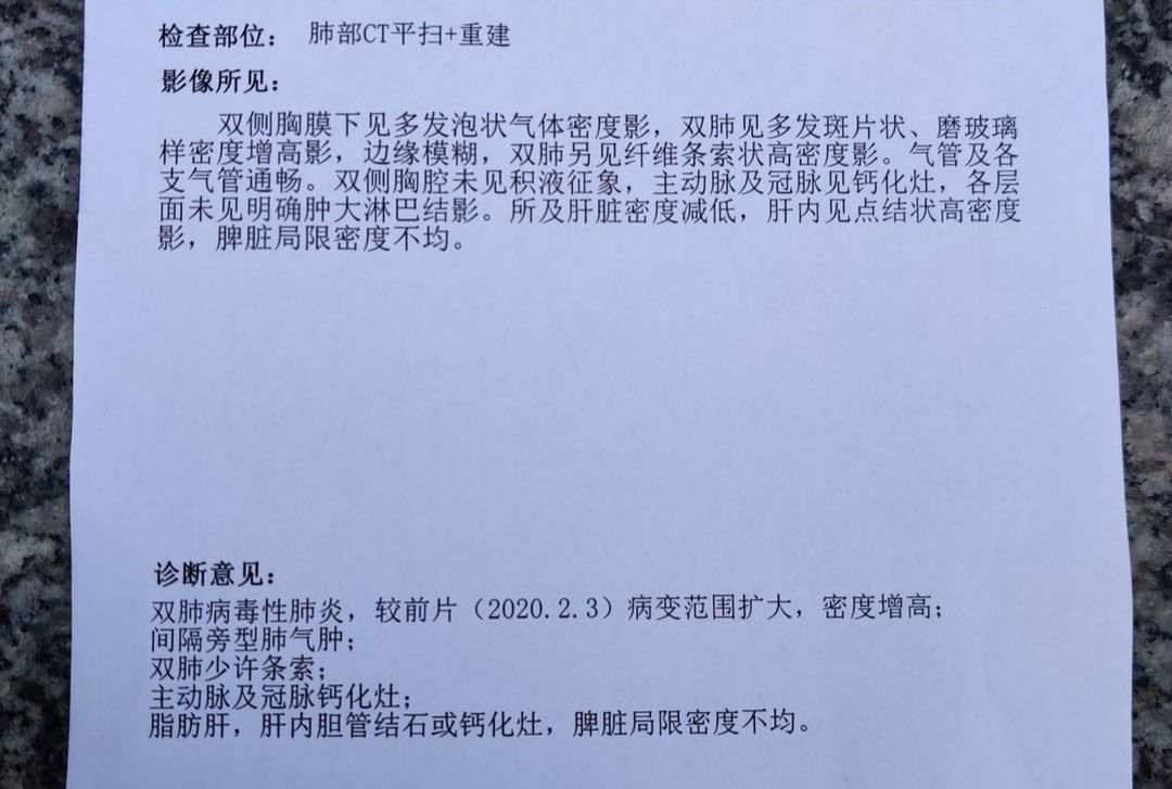 病毒性肺炎要治疗多长时间_病毒性肺炎怎么治疗_病毒性肺炎药物治疗