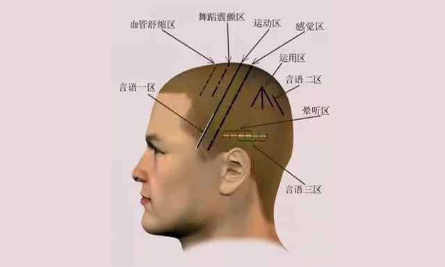上海蓝十字脑科医院医生_上海蓝十字脑科是三甲_上海蓝十字脑科医院