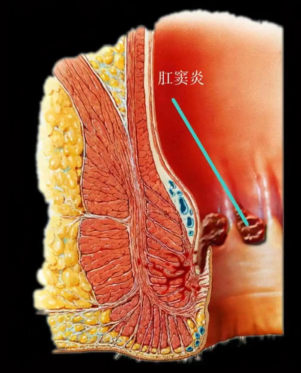 肛门扩大经历失禁会怎么样_肛门扩大失禁的经历_肛门扩大经历失禁怎么治疗
