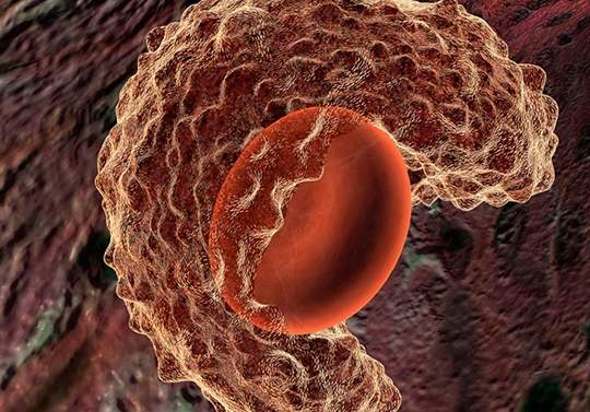 急性白血病治好概率_急性白血病治好了能活多久_急性白血病能治好吗