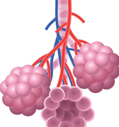 肺结核严重癌变会怎么样_肺结核严重了会癌变吗_肺结核癌变的几率大吗
