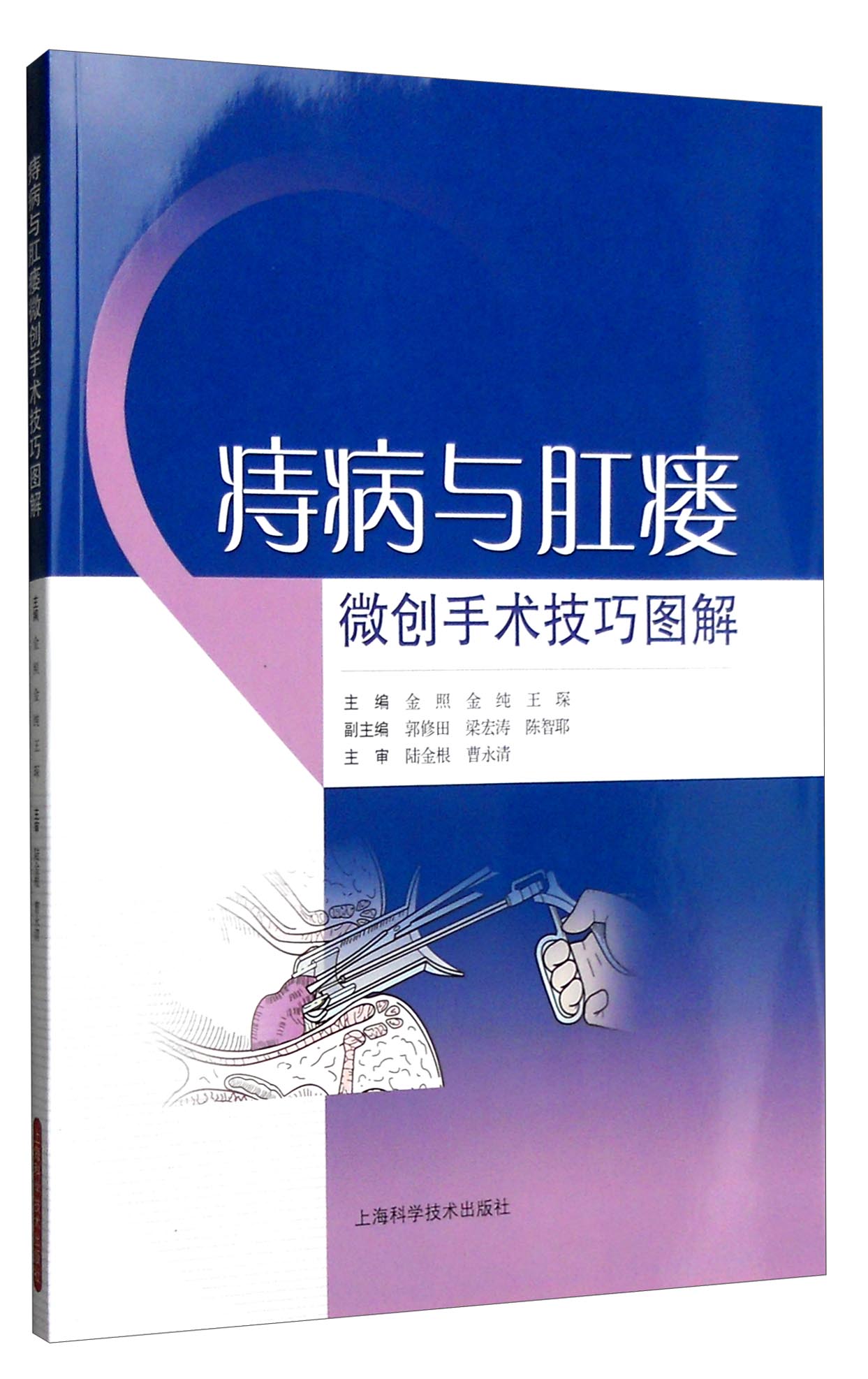 痔疮 肛瘘手术时间_手术痔疮肛瘘时间多长_痔疮肛瘘手术后几天能正常大便
