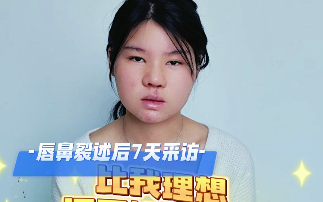 咳嗽嘴唇干燥怎么办_唇裂术后感冒咳嗽怎么办_唇裂术后哭闹会伤口裂开吗