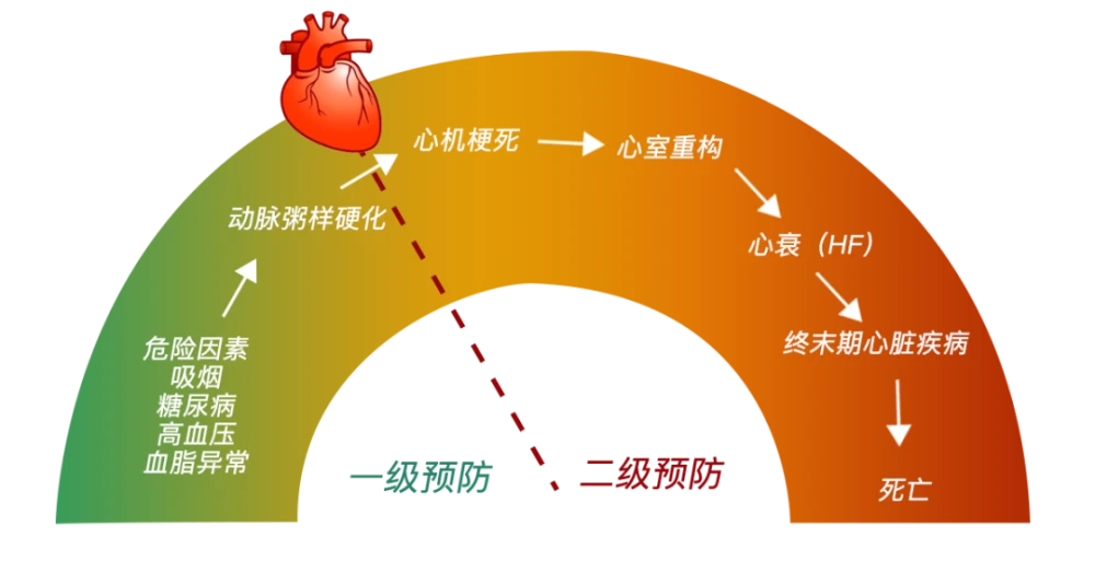 冠心病诊断与治疗指南发表_冠心病诊疗指南_指南诊疗冠心病最新