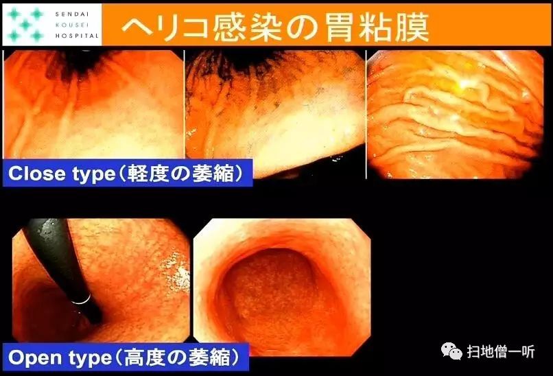 心跳过缓的自愈方法_心跳电视剧第24集免费观看_oracle rac心跳