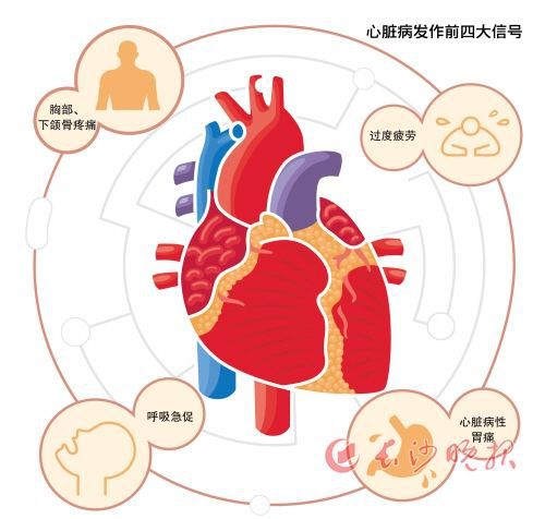冠心病护理计划单范文_护理冠心病标准计划怎么写_冠心病标准护理计划