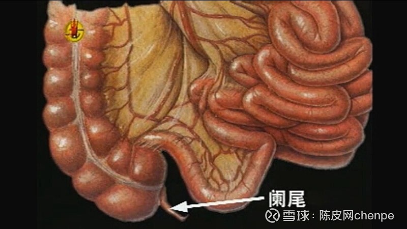 急性盲手术肠炎要住院多久_急性盲手术肠炎要住院几天_急性盲肠炎 手术要多久