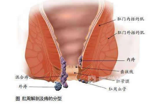 肛脱垂了怎么办_肛肠脱垂肛门失禁_肛门垂脱需要手术吗