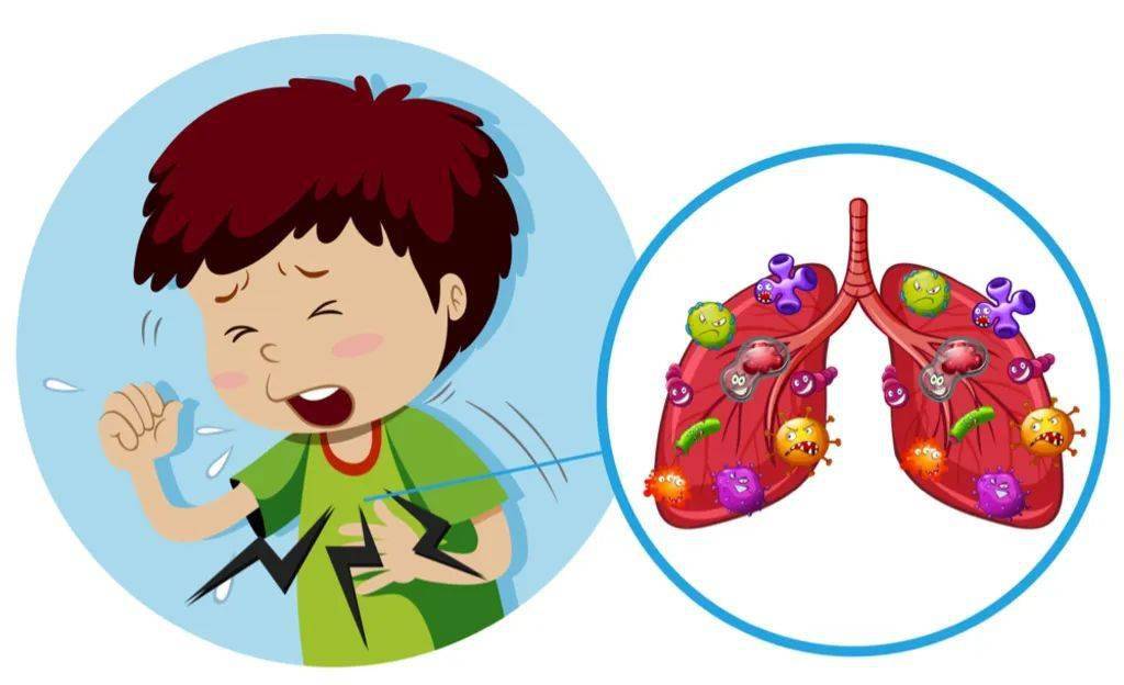 儿童支气管肺炎的治疗_支气管肺炎小儿治疗_儿童支气管肺炎常用药