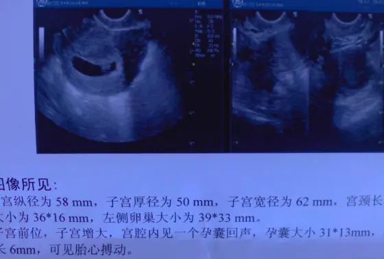 四维检查做多久_哪能做四维检查_能四维检查做唐筛吗