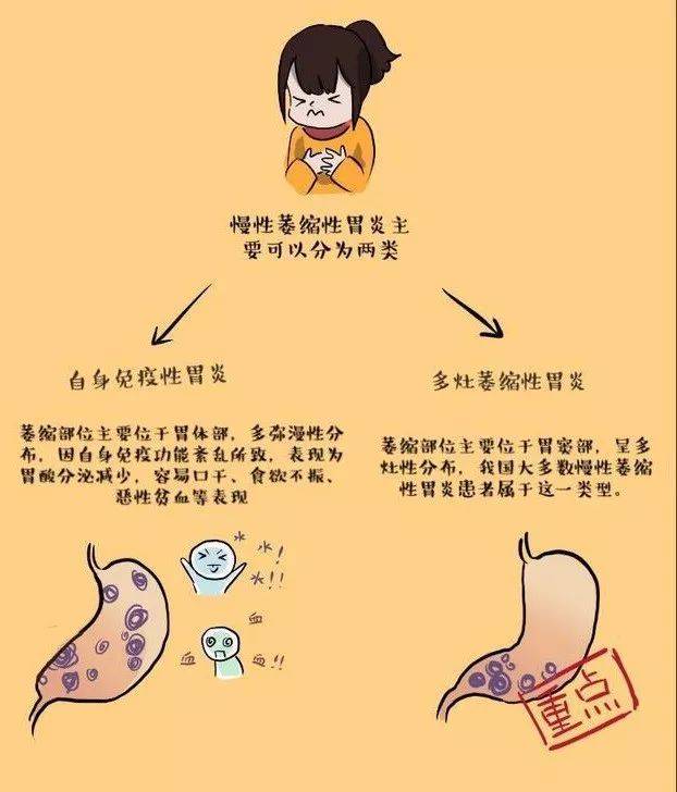 胃阴不足型慢性胃炎_胃阴虚慢性胃炎_慢性胃炎胃阴不足