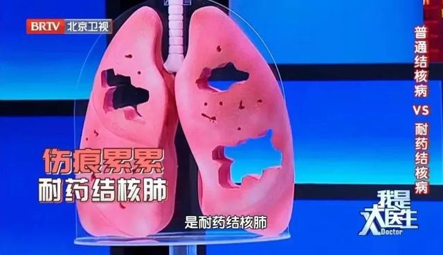 肺早期感染症状结核怎么治疗_感染肺结核早期症状_肺早期感染症状结核会传染吗