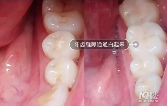 可数名词_可数名词和不可数名词_pollution可数吗