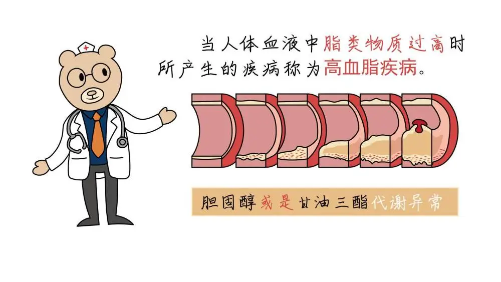 高血脂的护理计划_护理血脂计划高的原因_血脂高的护理诊断及护理措施