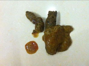 肛门拉大便出鲜血是怎么回事_大便拉出鲜血肛门痛_大便出鲜血便后肛门疼怎么回事