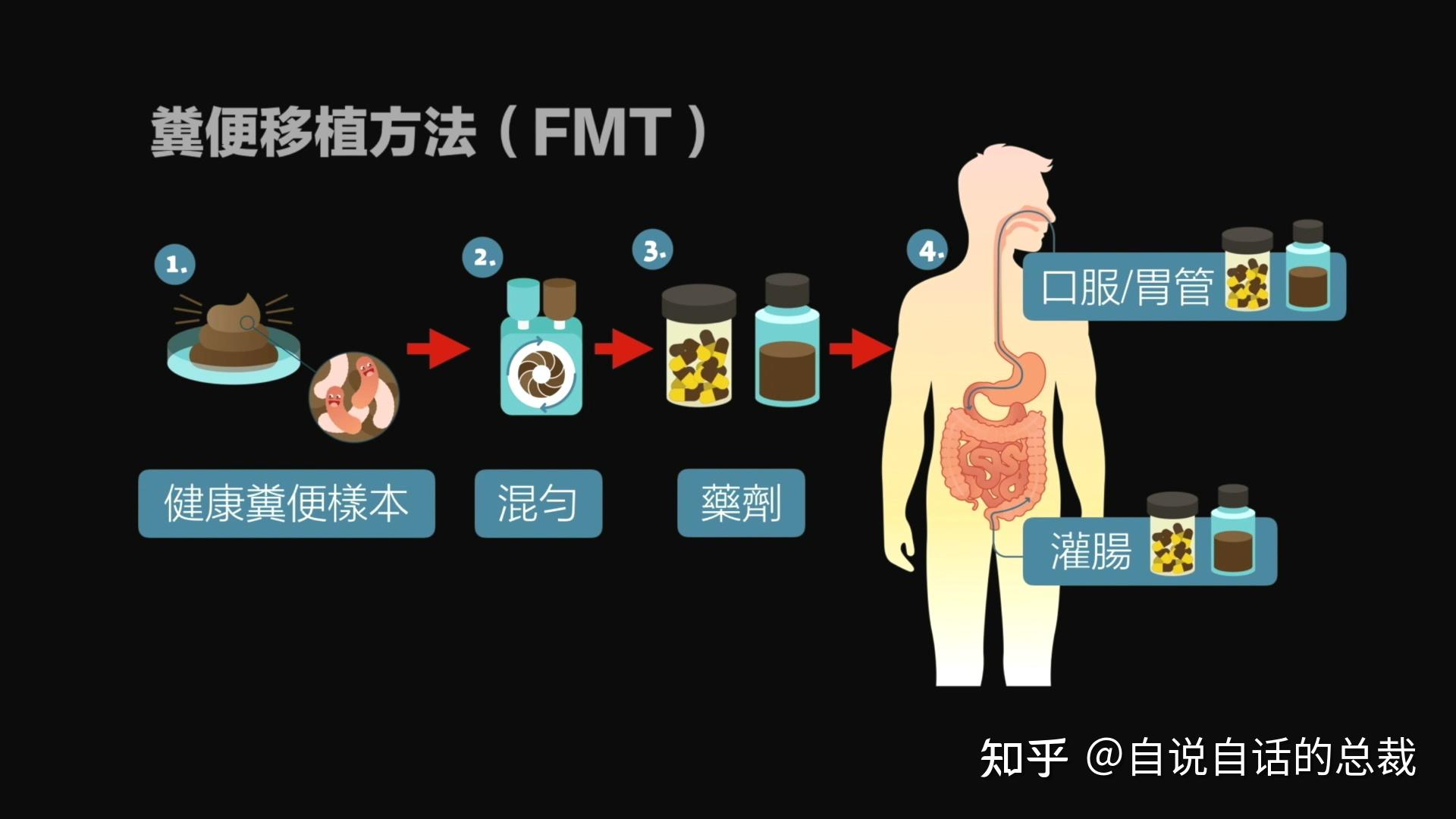 克罗恩导致的关节炎的症状_克罗恩病关节炎_克罗恩病关节炎治疗