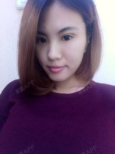 双眼皮拆线好天天换药吗_双眼皮今天拆线_双眼皮几天拆线最好