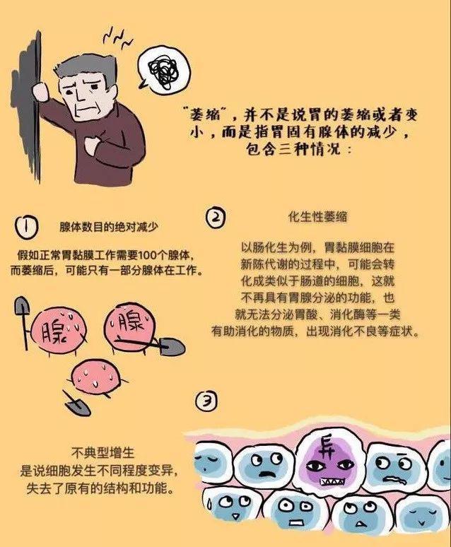 慢性胃炎胃阴不足_胃阴虚慢性胃炎_胃阴不足型慢性胃炎