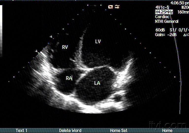 哮喘患者最长有几岁_哮喘寿命_哮喘最长能活多久