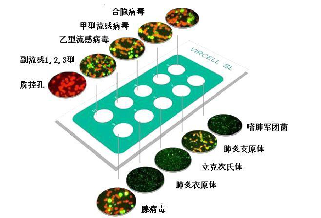 呼吸道合胞病毒/药物作用_呼吸合胞病毒感染用什么药_呼吸道合胞病毒抗病毒药物