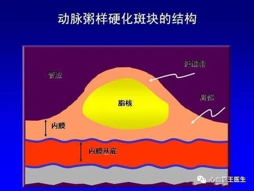 护理冠心病体会与感悟_冠心病护理的体会_护理冠心病患者护理体会