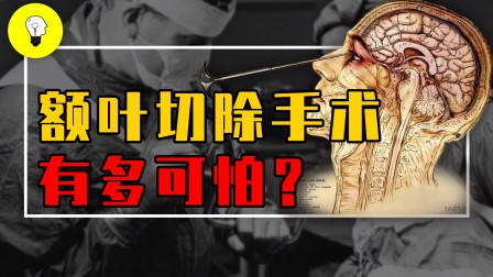 win7浏览器叠加_浏览器叠加在一起_ie浏览器叠加设置