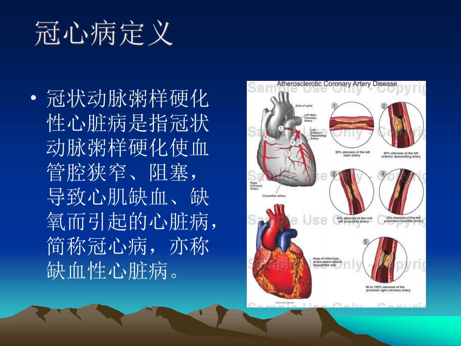 冠心病诊断病历书写顺序_冠心病病例报告_冠心病病例