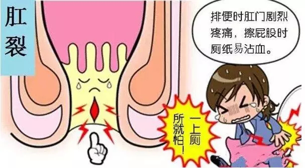 肛门症状排便失禁怎么办_肛门失禁的症状不排便_肛门症状排便失禁怎么回事