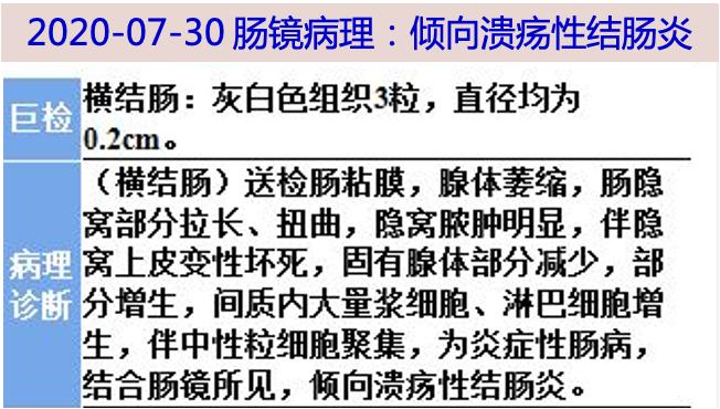 罗克罗恩病的特征性体征_克罗恩病/诊断_罗克恩病是什么病