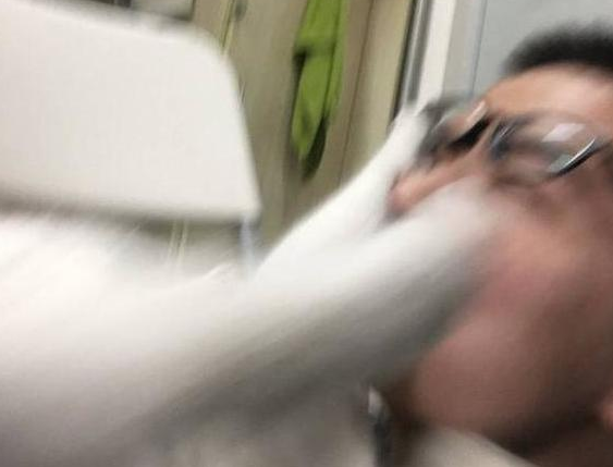 猫咪趁主人睡着后一巴掌扇脸上，下一幕令人锥心的疼！