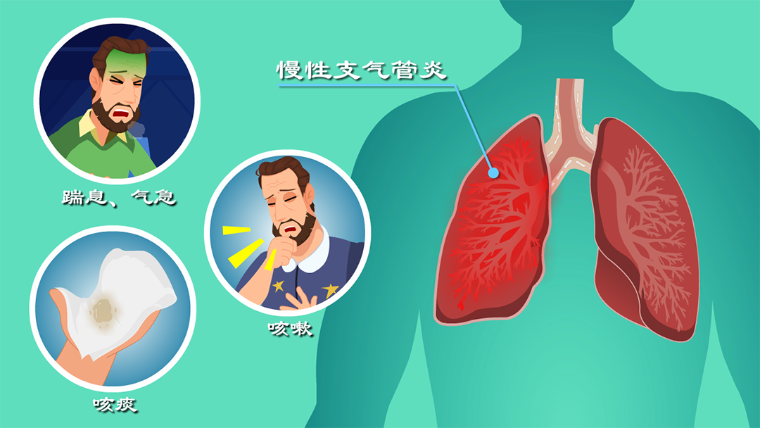 小孩咳嗽变异性哮喘症状_咳嗽变异哮喘症状小孩性传染吗_咳嗽变异性哮喘能治愈吗小孩