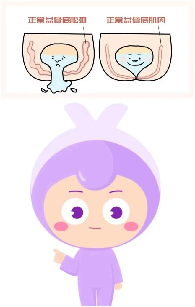 肛门失禁最常见的并发症_肛门病因失禁症状_肛门失禁病因
