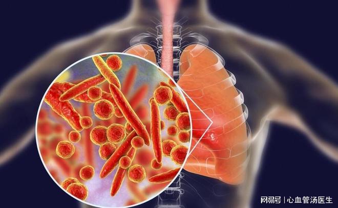儿童医院看肺炎_肺炎治疗儿童医院全国有多少家_全国治疗儿童肺炎的医院