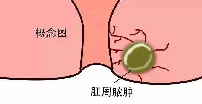 肛门失禁是怎么回事_男同肛门失禁_肛门失禁的可以治疗吗