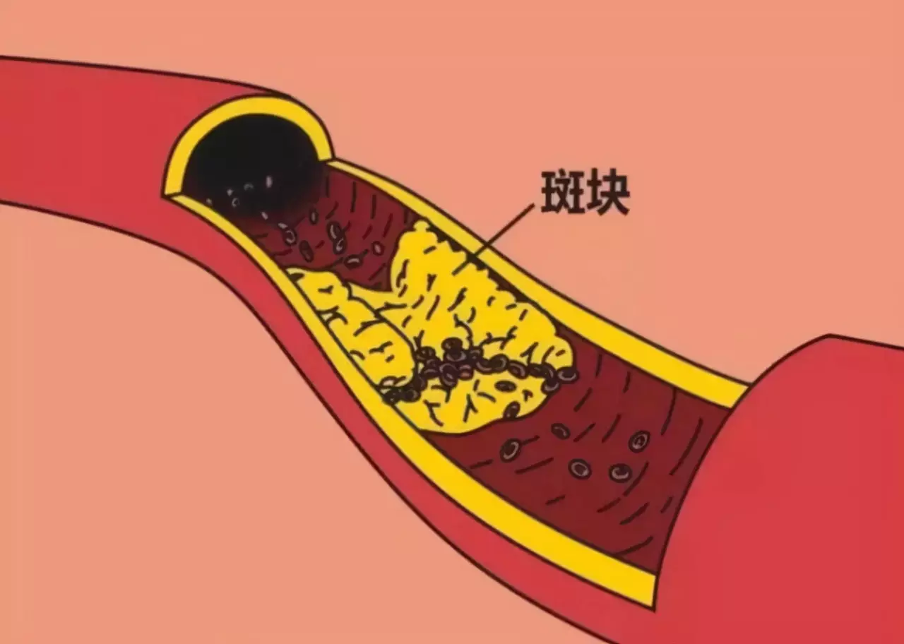 朝阳医院西院体检中心_北京朝阳医院京西院区体检中心_朝阳医院西区体检中心