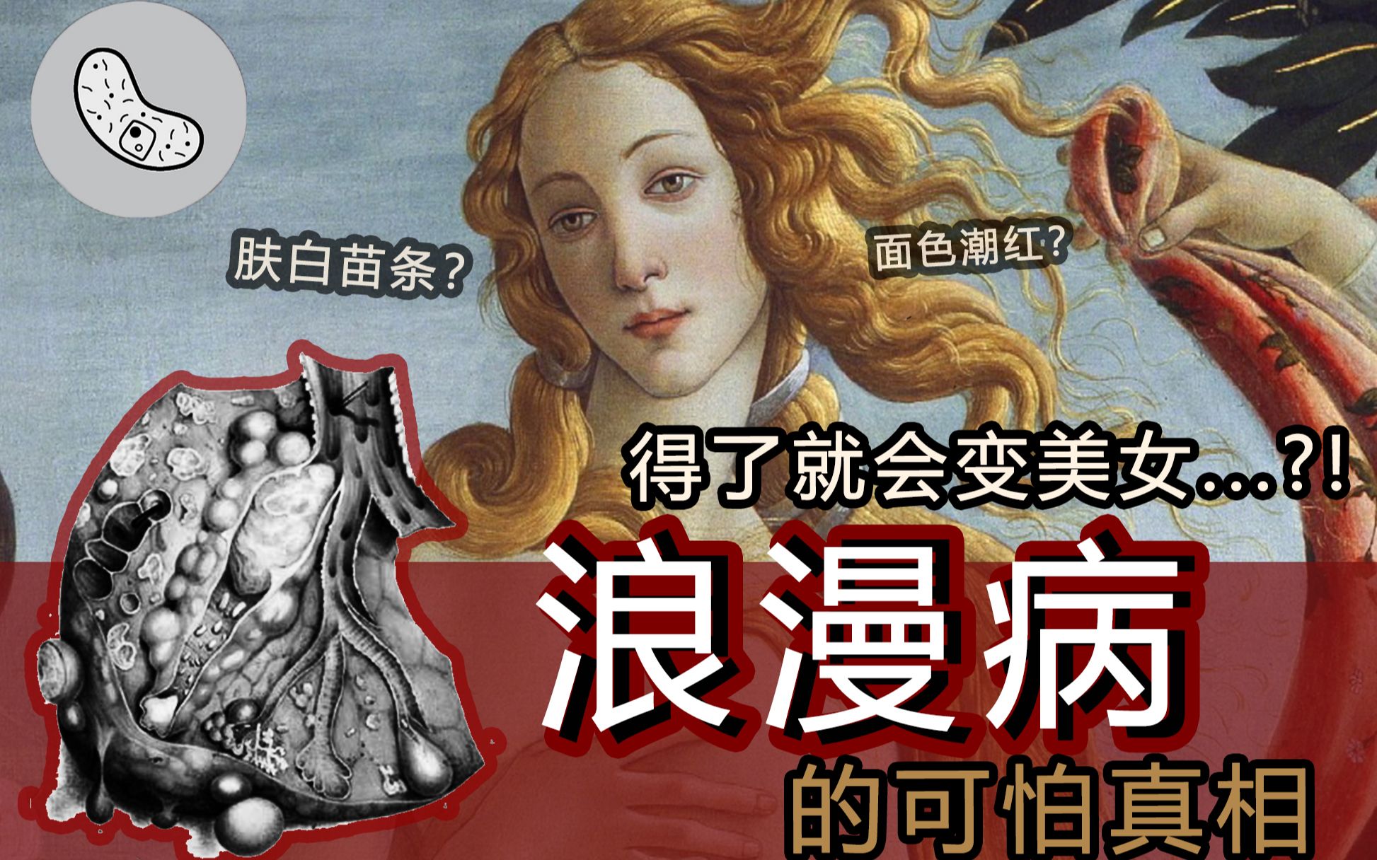 肺结核咳白痰有传染性吗_肺结核白痰_肺结核白痰黄痰的图片