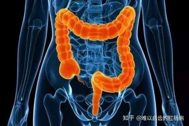 肛门手术引起失禁肛瘘的原因_肛门手术引起失禁肛瘘怎么办_肛瘘手术引起肛门失禁