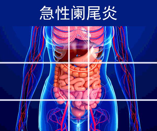 急性盲肠炎 病因_急性盲肠炎症状和体征_急性盲肠炎是什么原因引起的