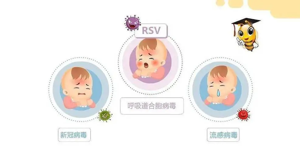呼吸道合胞病毒感染会传染吗_呼吸道合胞病毒感染_呼吸道合胞体病毒感染