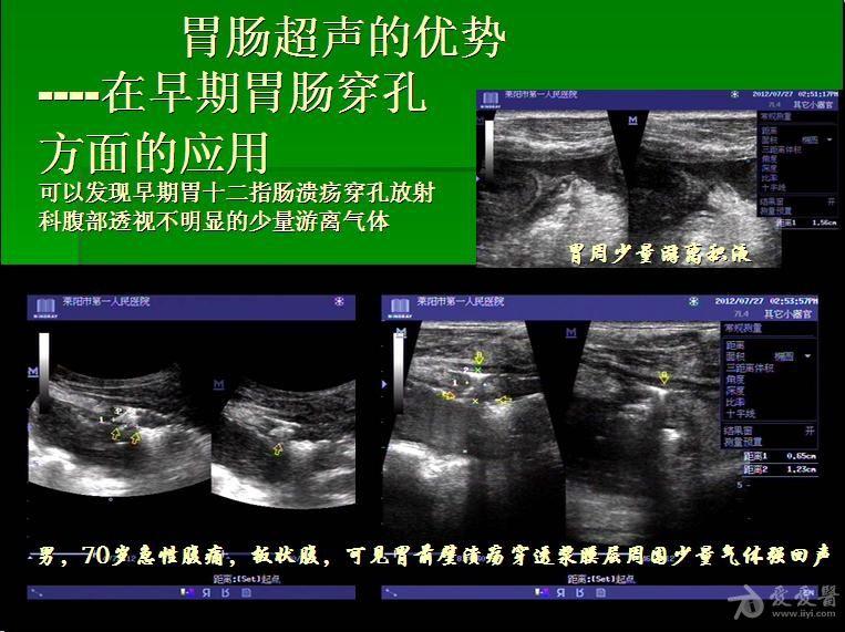 老胃病怎么治_老胃病吧_老胃病 论坛